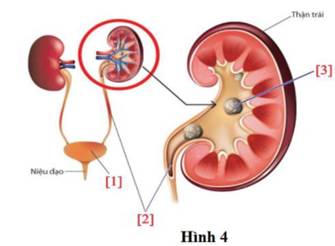 C&acirc;u 3: H&igrave;nh 4 m&ocirc; tả thận, bệnh sỏi thận v&agrave; đường tiết niệu như sau: a) B&agrave;ng quang [1] l&agrave; nơi chứa c&aacute;c sản phẩm thải của thận. b) Ống dẫn