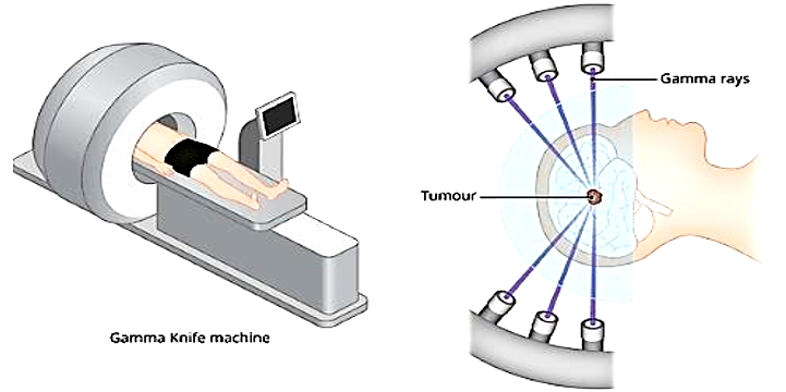 A diagram of a person on a machine
AI-generated content may be incorrect.
