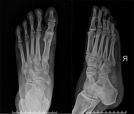 Những điều cần biết về chụp X-quang bàn chân