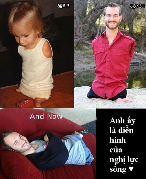 Nick Vujicic Tấm gương điển hình của nghị lực sống phi thường